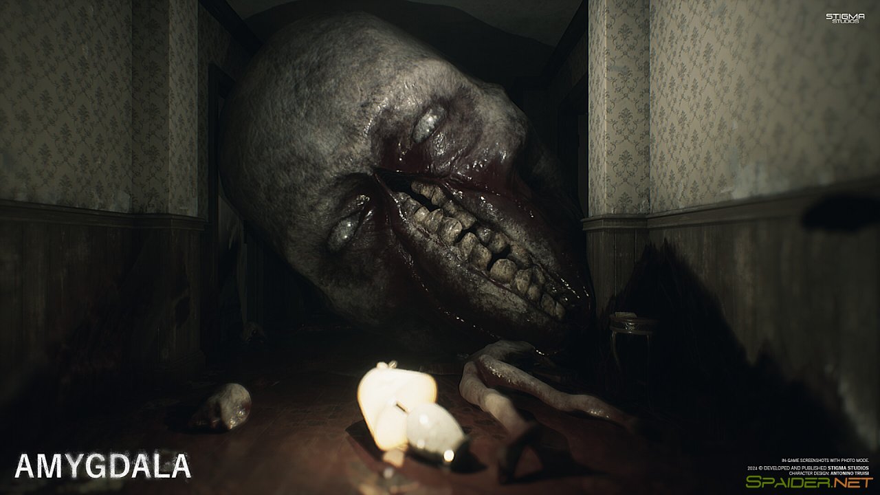 Amygdala 1 Amygdala 1